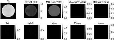 High Resolution Ex Vivo Diffusion Tensor Distribution MRI of Neural Tissue
